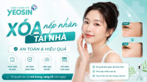 cách xóa nếp nhăn vùng mắt tại nhà