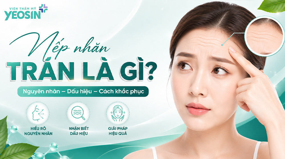 Nếp nhăn trán là gì?