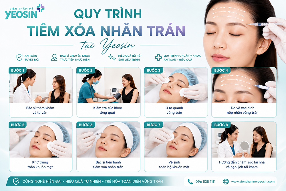 Quy trình tiêm xóa nhăn trán tại Viện Thẩm Mỹ Yeosin