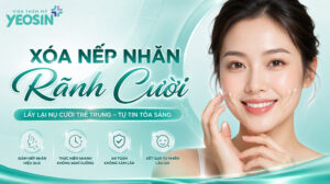 Xóa rãnh cười: