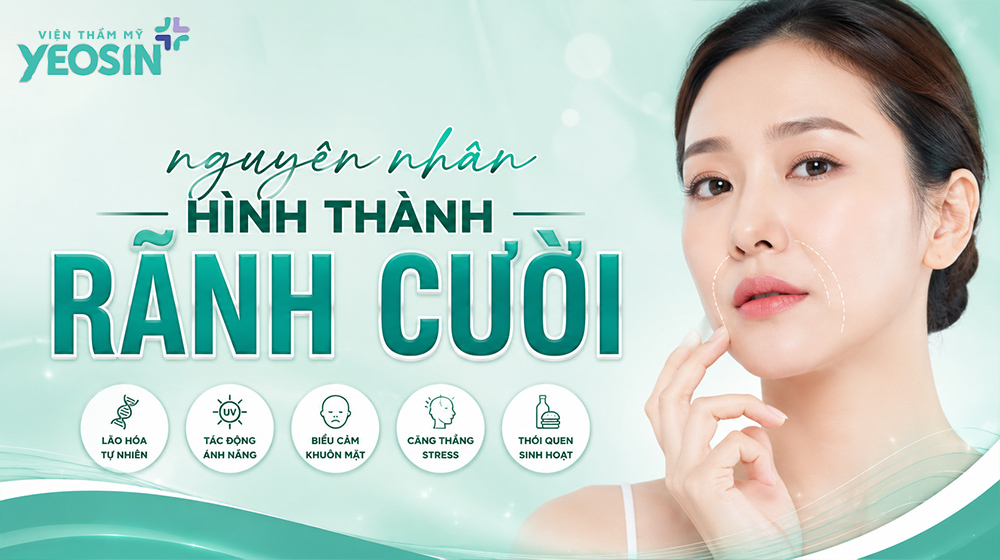 Xóa rãnh cười: Nguyên nhân và cách xóa nếp nhăn rãnh cười 8 Nguyên nhân hình thành rãnh cười