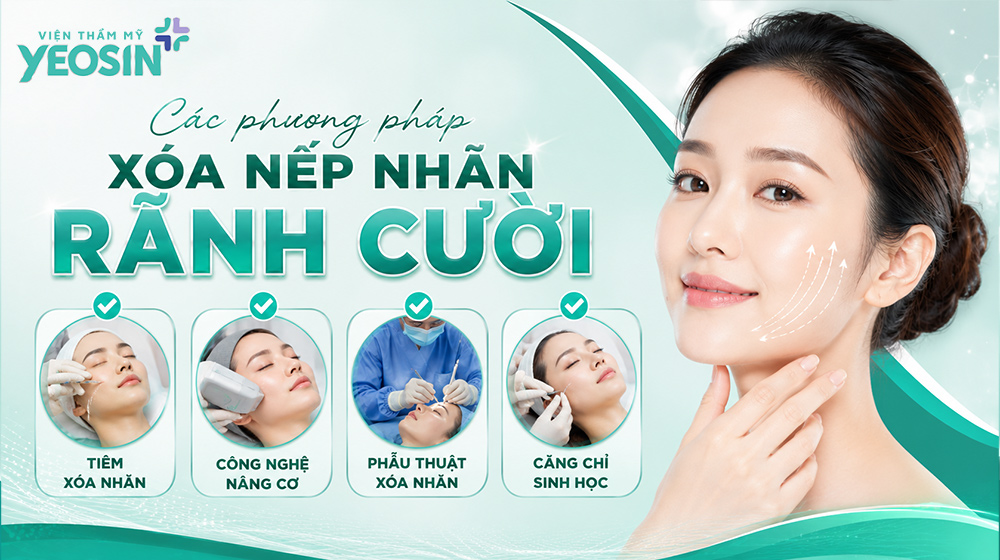 Xóa rãnh cười: Nguyên nhân và cách xóa nếp nhăn rãnh cười 9 Các phương pháp xóa nếp nhăn rãnh cười phổ biến