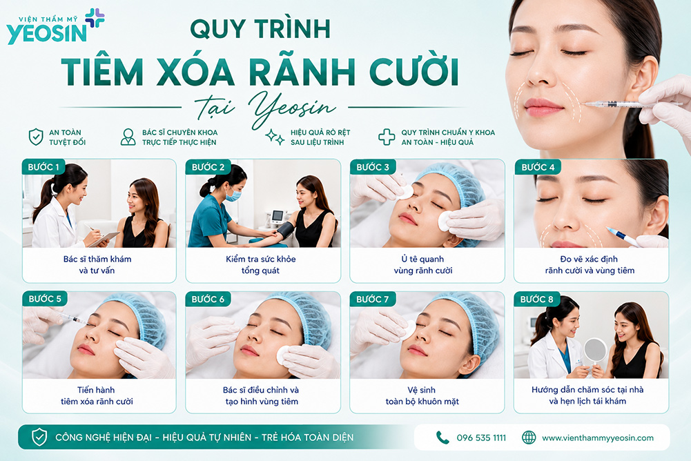Xóa rãnh cười: Nguyên nhân và cách xóa nếp nhăn rãnh cười 11 Quy trình thực hiện tiêm xóa nhăn rãnh cười tại Yeosin
