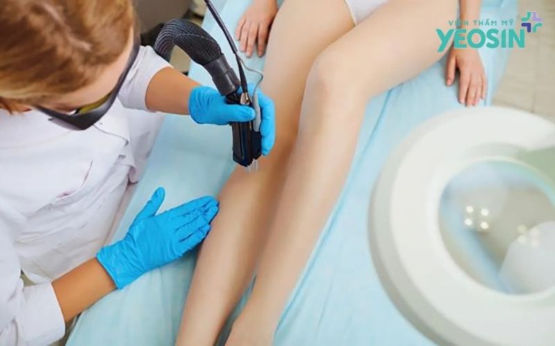 Công nghệ trị thâm chân Bio Skin là gì?