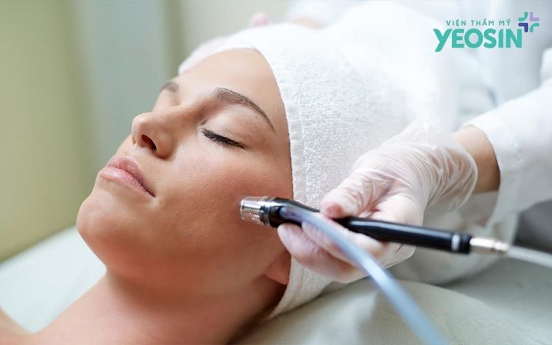 Vì sao thoa kem hay dùng serum không bao giờ hết sẹo rỗ? 8 Tổng quan các phương pháp điều trị sẹo rỗ hiện nay
