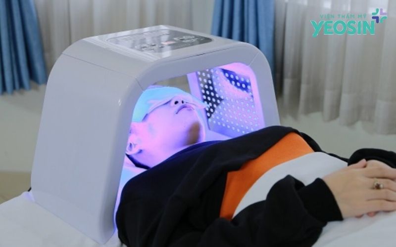 Công nghệ ánh sáng sinh học Bio Peel - Đột phá trong điều trị viêm nang lông tại Yeosin