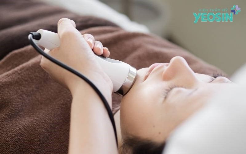 Hút chì thải độc da có tốt không? Sự thật cần biết 5 Những lợi ích thực tế từ liệu trình làm sạch sâu