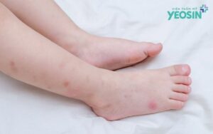 anh Yeosin 1