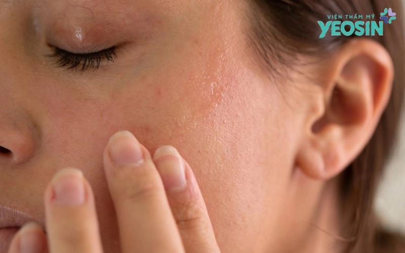 Phun oxy tươi chăm sóc da mặt có thực sự hiệu quả? 5 Những ai nên / không nên lựa chọn liệu trình phun oxy tươi?