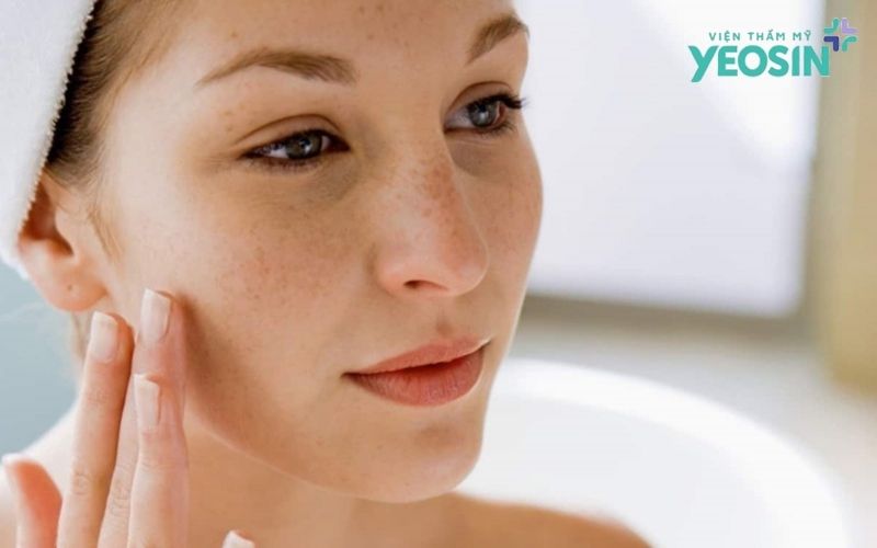 Bí quyết Skincare cho da bị nám giúp da đều màu, sáng mịn 8 Những sai lầm cần tránh khi chăm sóc da nám tại nhà