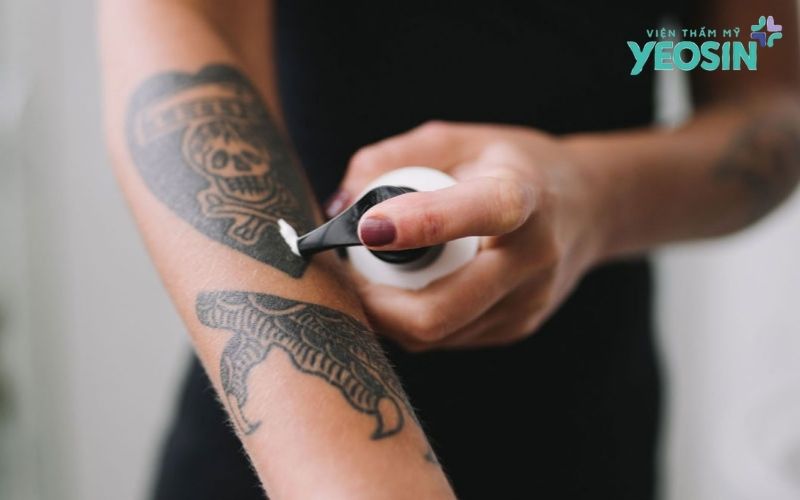 Vì sao nhiều người muốn tự xóa xăm tại nhà?