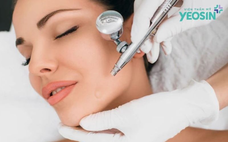 Phun oxy tươi chăm sóc da mặt có thực sự hiệu quả? 6 Quy trình chăm sóc da chuẩn khi phun oxy tươi