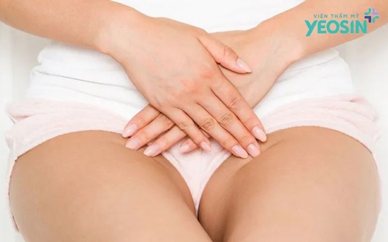 Thâm bẹn là gì?