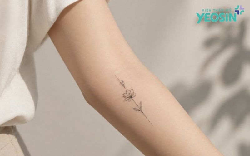 Tự xóa xăm tại nhà có thực sự an toàn?