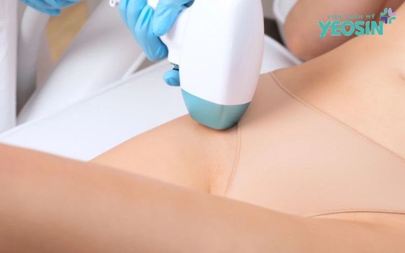 Các phương pháp điều trị thâm bẹn hiện nay