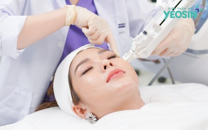 Tiêm meso tại Yeosin - Trải nghiệm làm đẹp an toàn, chuẩn y khoa
