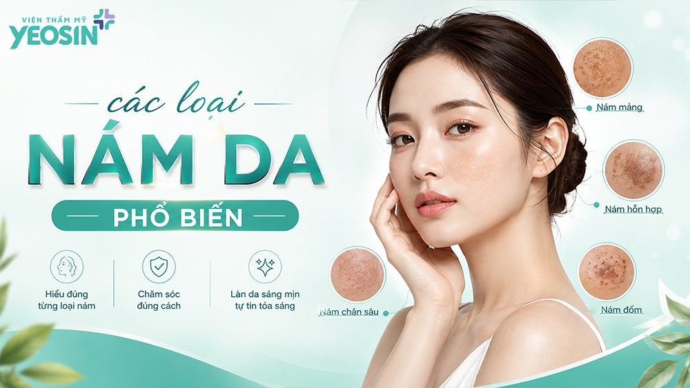 Các loại nám da phổ biến: Cách phân biệt và điều trị hiệu quả