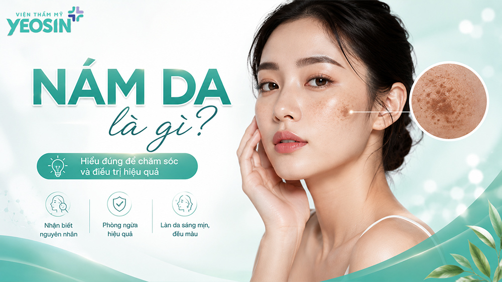 Các loại nám da phổ biến: Cách phân biệt và điều trị hiệu quả 6 Nám da là gì?