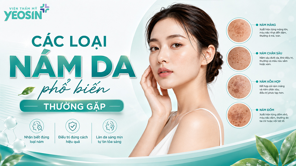 Các loại nám da phổ biến: Cách phân biệt và điều trị hiệu quả 7 Các loại nám da phổ biến thường gặp hiện nay