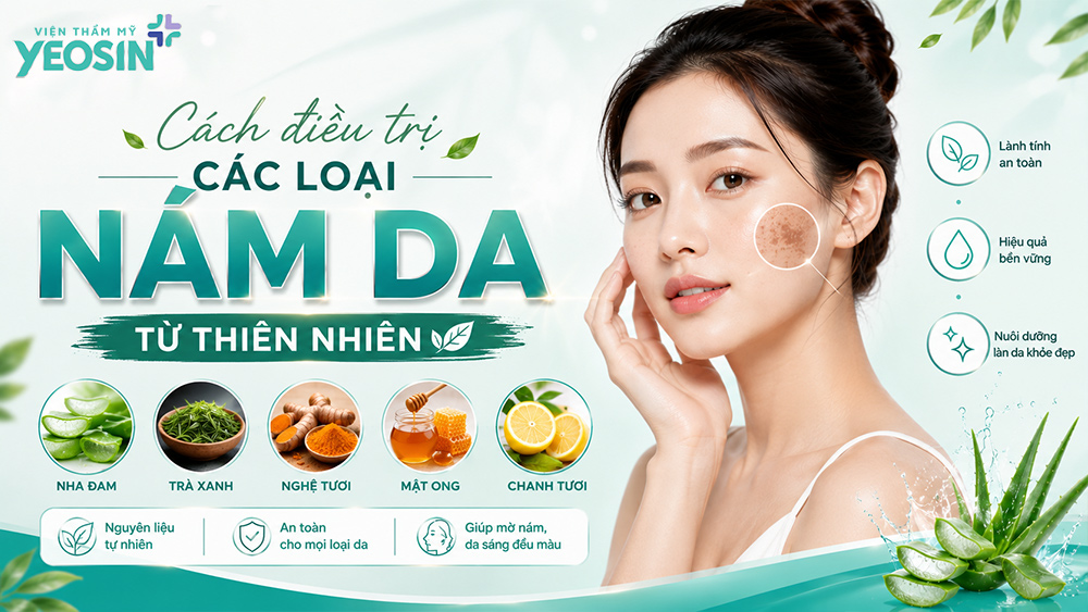 Các loại nám da phổ biến: Cách phân biệt và điều trị hiệu quả 8 Cách điều trị các loại nám da từ thiên nhiên