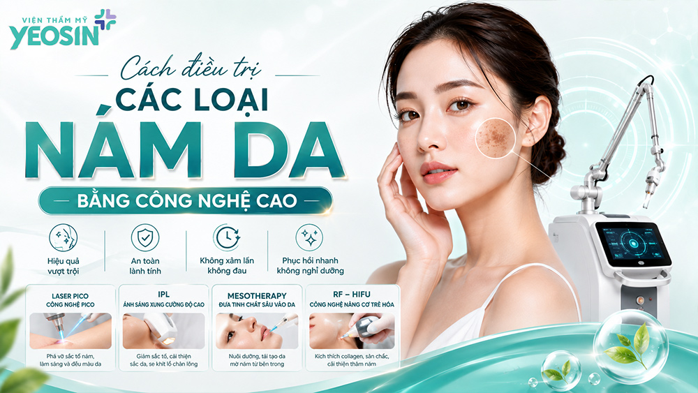 Các loại nám da phổ biến: Cách phân biệt và điều trị hiệu quả 9 Cách điều trị các loại nám da an toàn và hiệu quả bằng công nghệ cao
