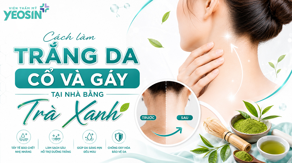 Gợi ý 10 cách làm trắng da cổ và gáy tại nhà 19 Cách làm trắng da cổ và gáy tại nhà bằng trà xanh