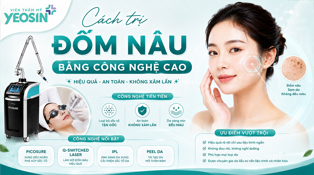 Cách trị đốm nâu trên gò má bằng công nghệ cao
