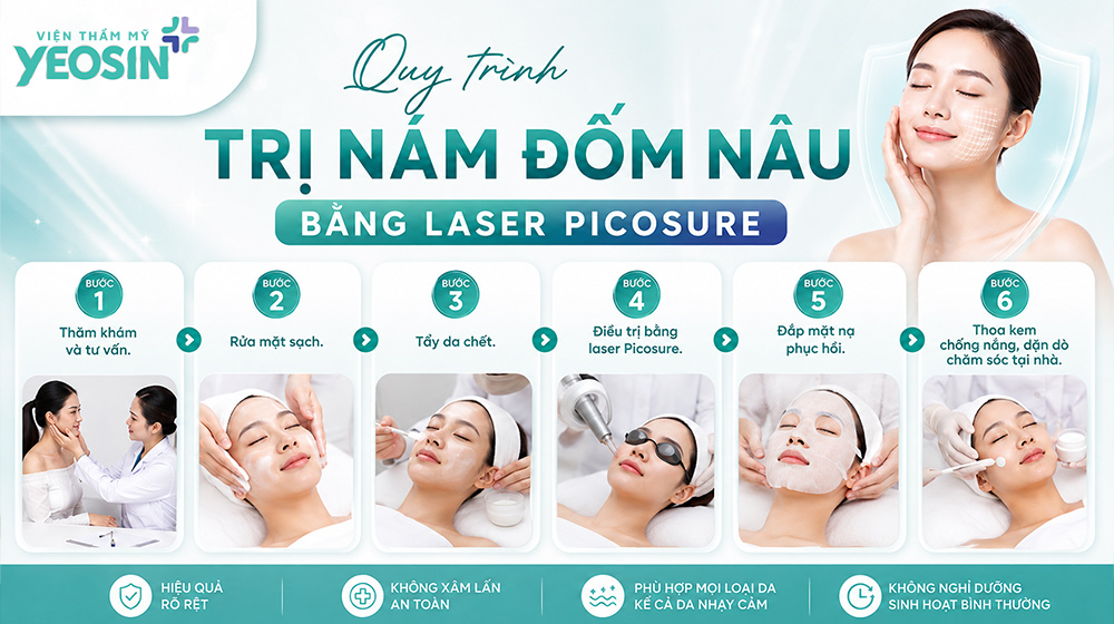 Quy trình điều trị nám đốm nâu trên da mặt bằng laser Picosure