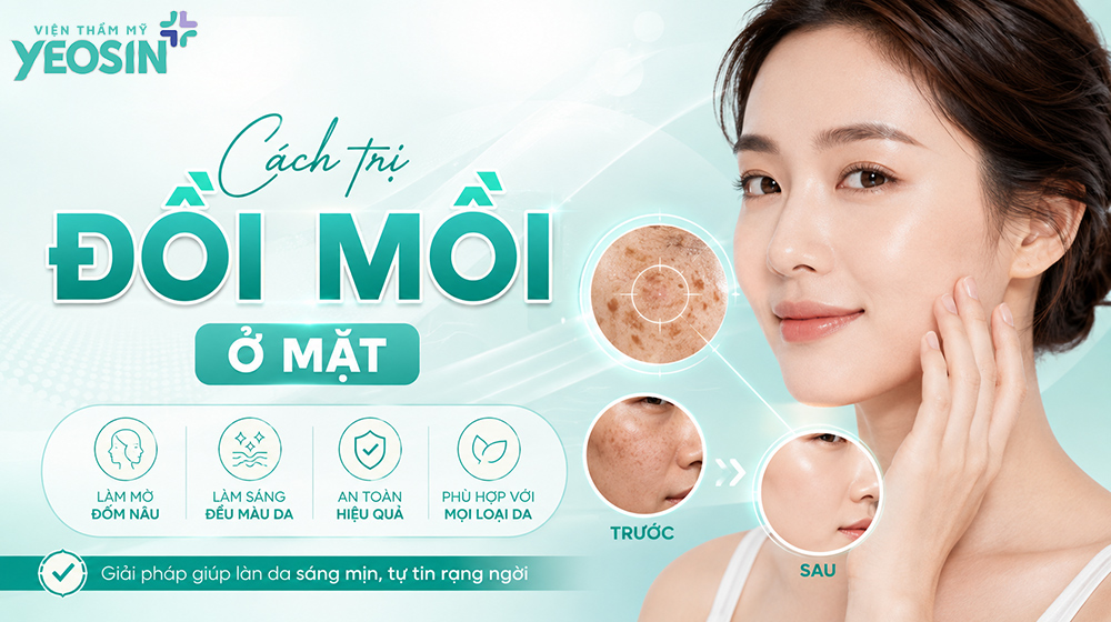 Cách điều trị đồi mồi ở mặt hiệu quả và an toàn