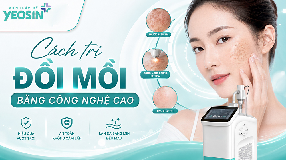 Cách trị đồi mồi ở mặt bằng công nghệ cao