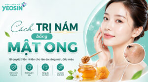 cách trị nám bằng mật ong hiệu quả tại nhà