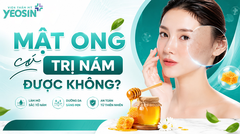 Mật ong có trị nám được không?