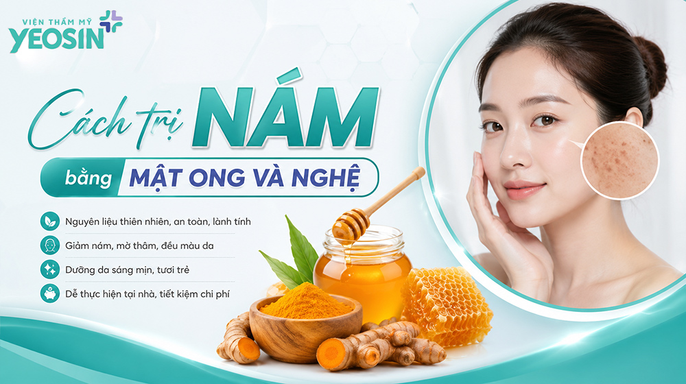 Cách làm nghệ ngâm mật ong trị nám