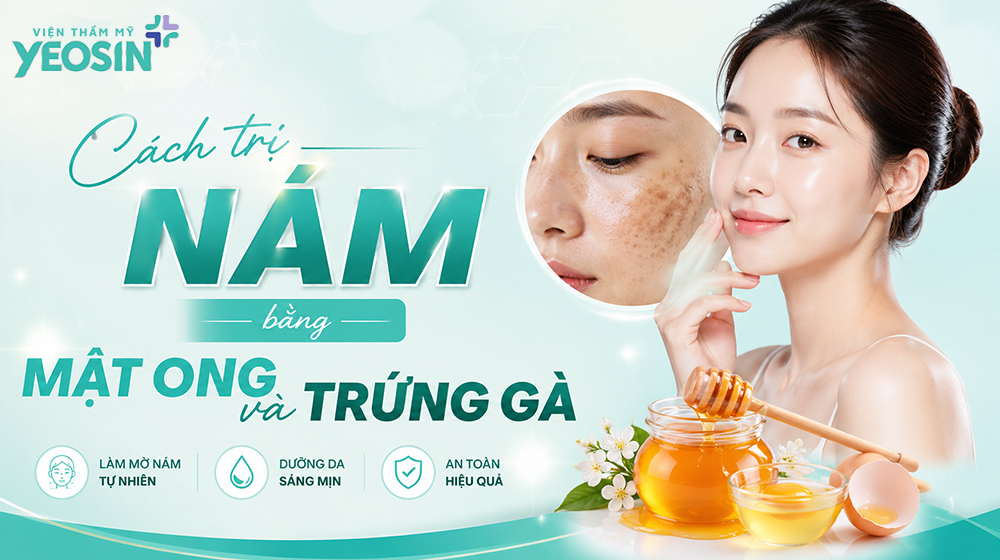 Cách trị nám bằng mật ong và lòng trắng trứng