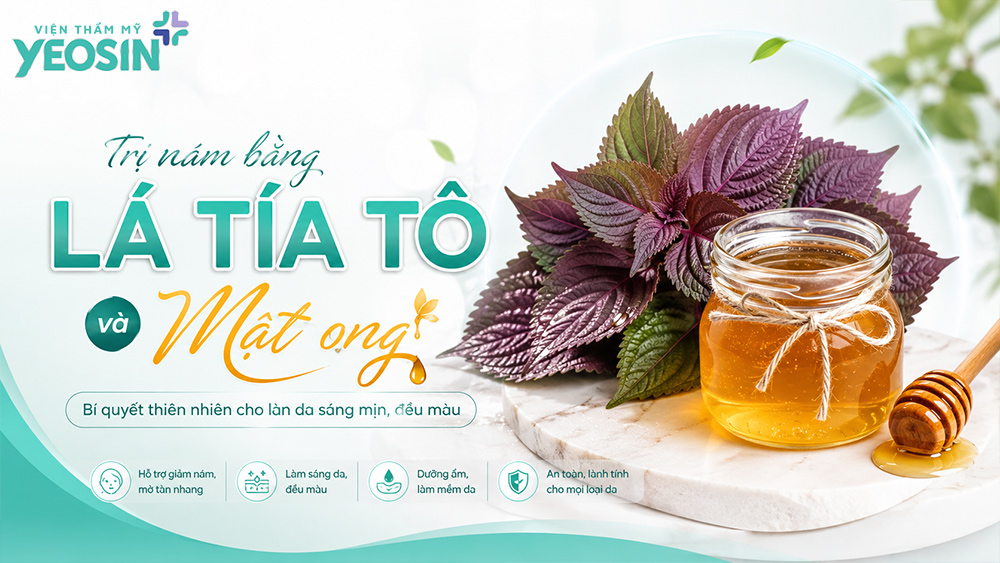 Cách trị nám bằng lá tía tô và mật ong