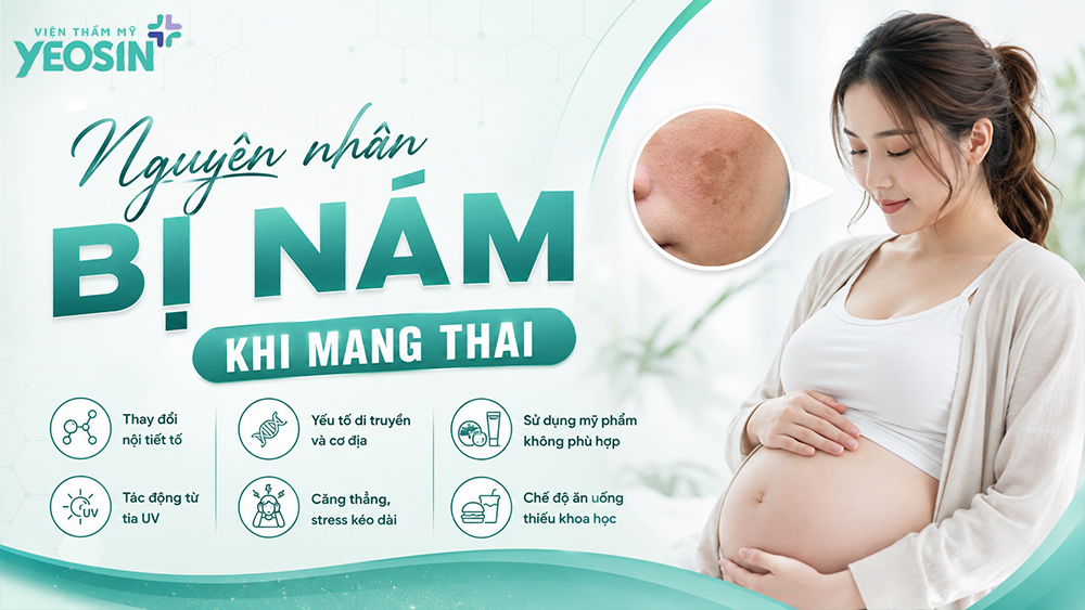 10 cách trị nám da dành cho bà bầu dân gian tại nhà 8 Nguyên nhân xuất hiện nám tàn nhang khi mang thai