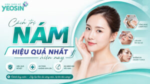 Bật mí 8 cách trị nám hiệu quả nhất hiện nay