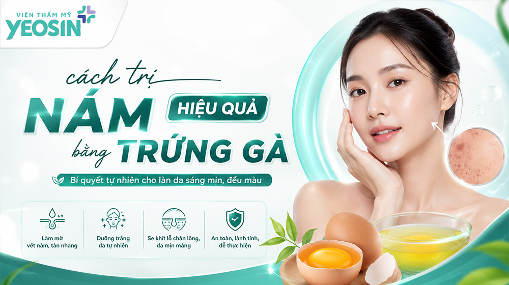 Cách điều trị nám hiệu quả bằng trứng gà