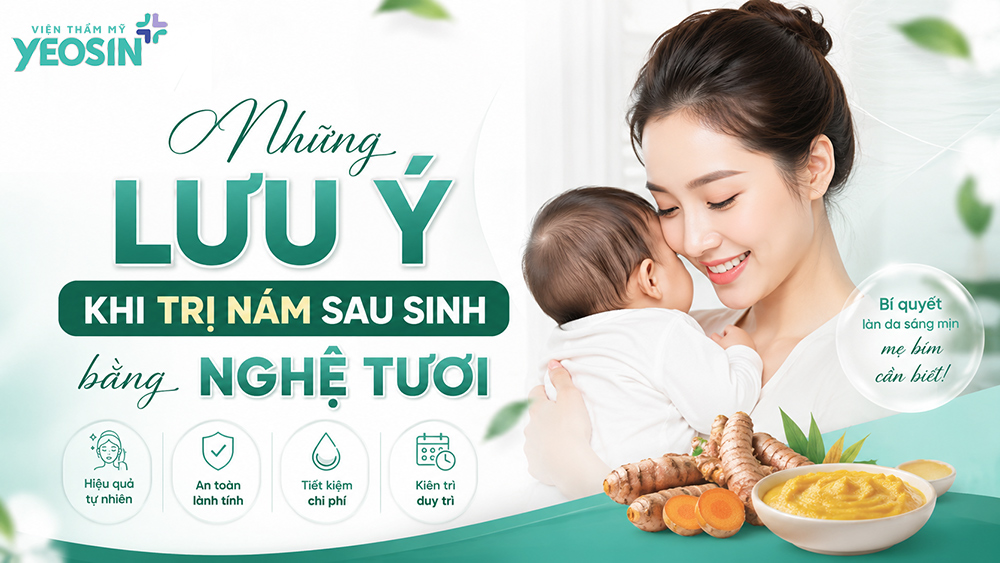 Những lưu ý khi trị nám sau sinh bằng nghệ tươi