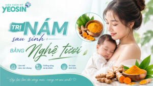cách trị nám sau sinh bằng nghệ tươi