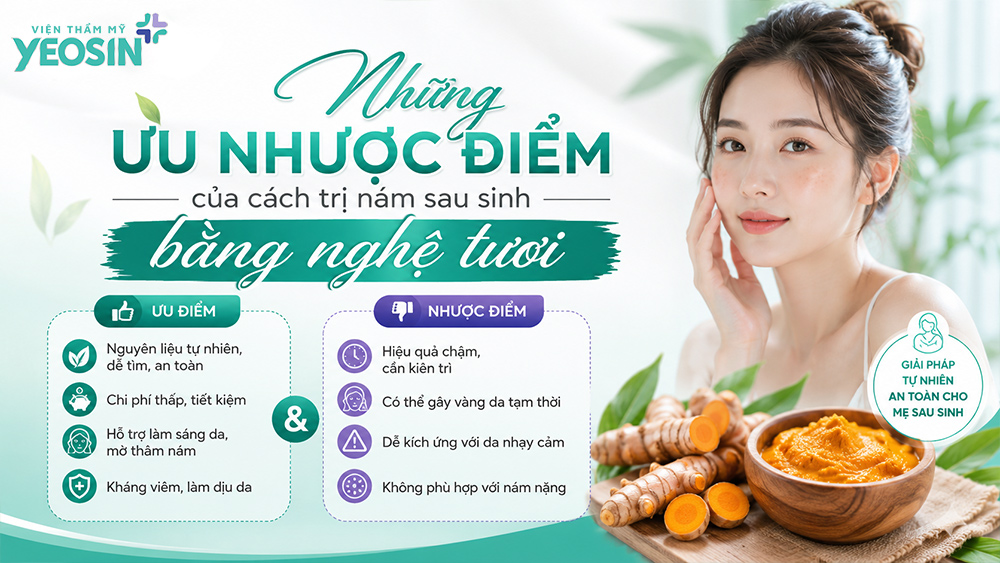 Những ưu nhược điểm của cách trị nám sau sinh bằng nghệ tươi