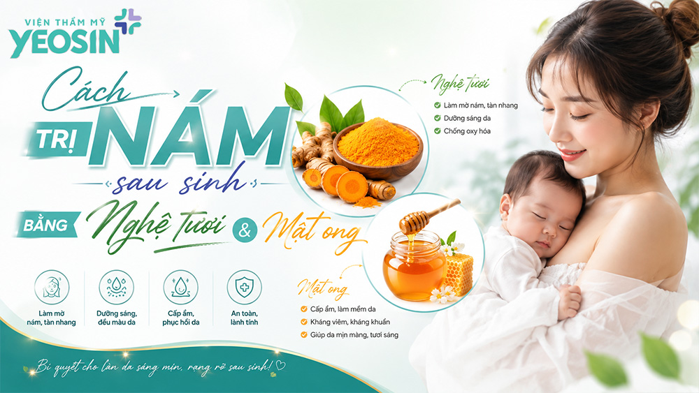 Chia sẻ 10 cách trị nám sau sinh bằng nghệ tươi 8 Cách trị nám sau sinh bằng nghệ tươi và mật ong
