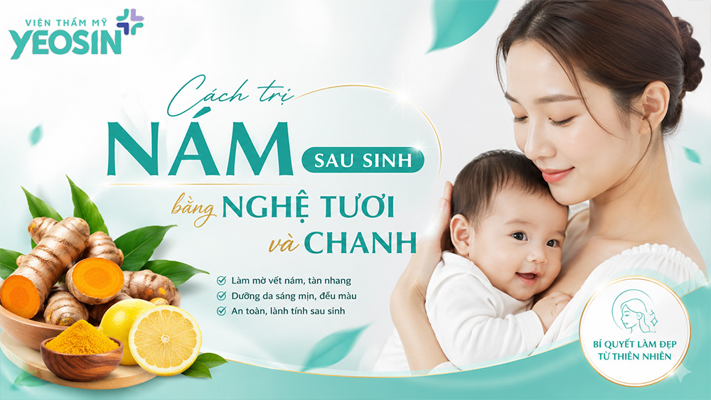 Chia sẻ 10 cách trị nám sau sinh bằng nghệ tươi 9 Kết hợp chanh là cách trị nám sau sinh bằng nghệ tươi hiệu quả