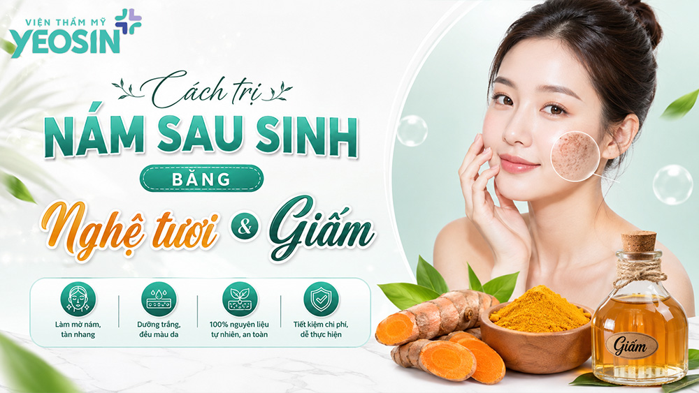 Chia sẻ 10 cách trị nám sau sinh bằng nghệ tươi 10 Cách trị nám tàn nhang sau sinh bằng nghệ tươi và giấm trắng