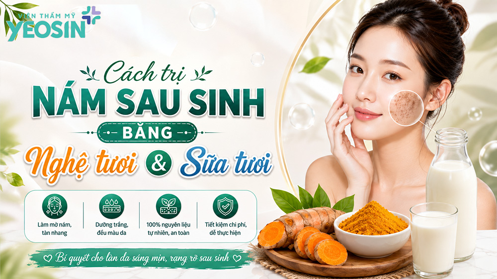 Chia sẻ 10 cách trị nám sau sinh bằng nghệ tươi 11 Cách điều trị nám sau sinh bằng nghệ tươi và sữa tươi