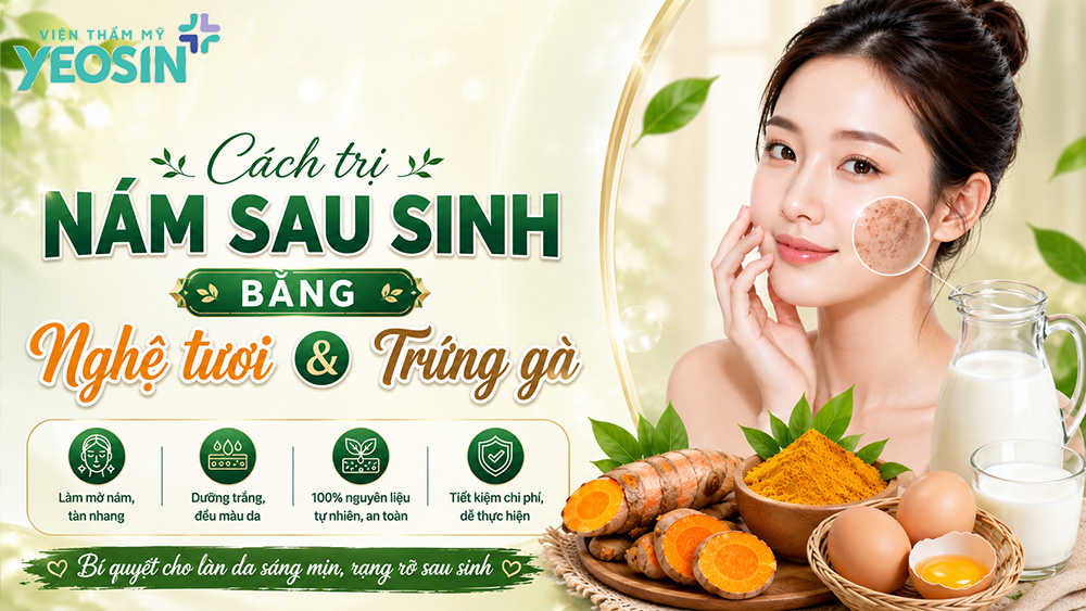 Chia sẻ 10 cách trị nám sau sinh bằng nghệ tươi 12 Cách chữa nám sau sinh bằng nghệ tươi và trứng gà