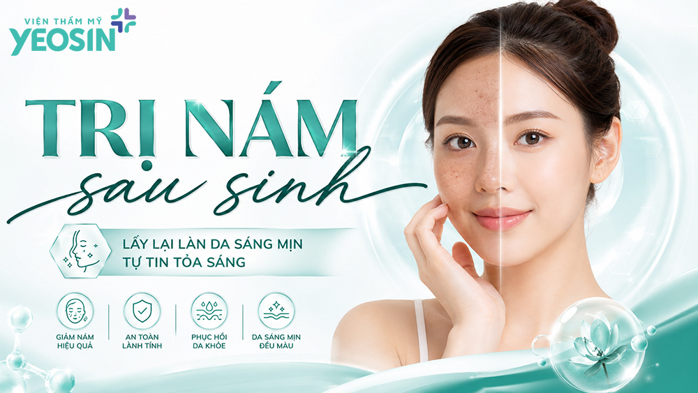 Cách trị nám sau sinh an toàn và hiệu quả