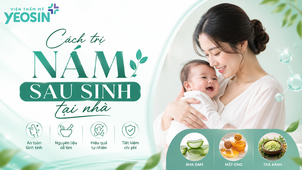 Cách trị nám sau sinh an toàn và hiệu quả 10 Cách trị nám sau sinh tại nhà an toàn và hiệu quả