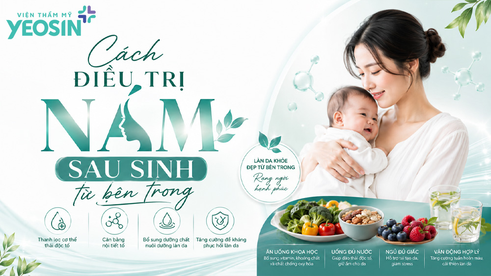 Cách trị nám sau sinh an toàn và hiệu quả 11 Cách điều trị nám sau sinh từ bên trong
