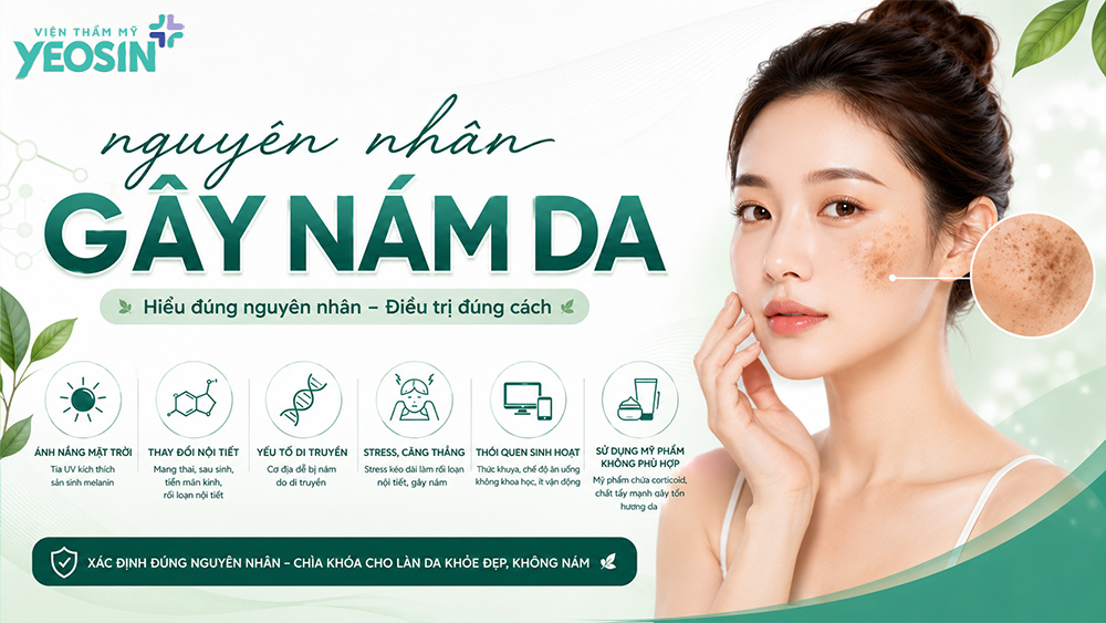 Top 10 cách trị nám tại nhà an toàn và hiệu quả 9 Nguyên nhân hình thành nám da